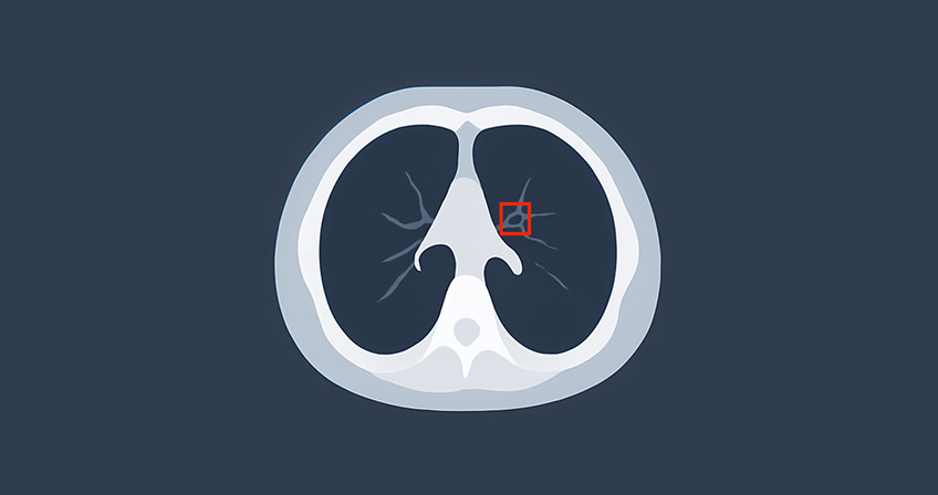 Predictive Tumour App
